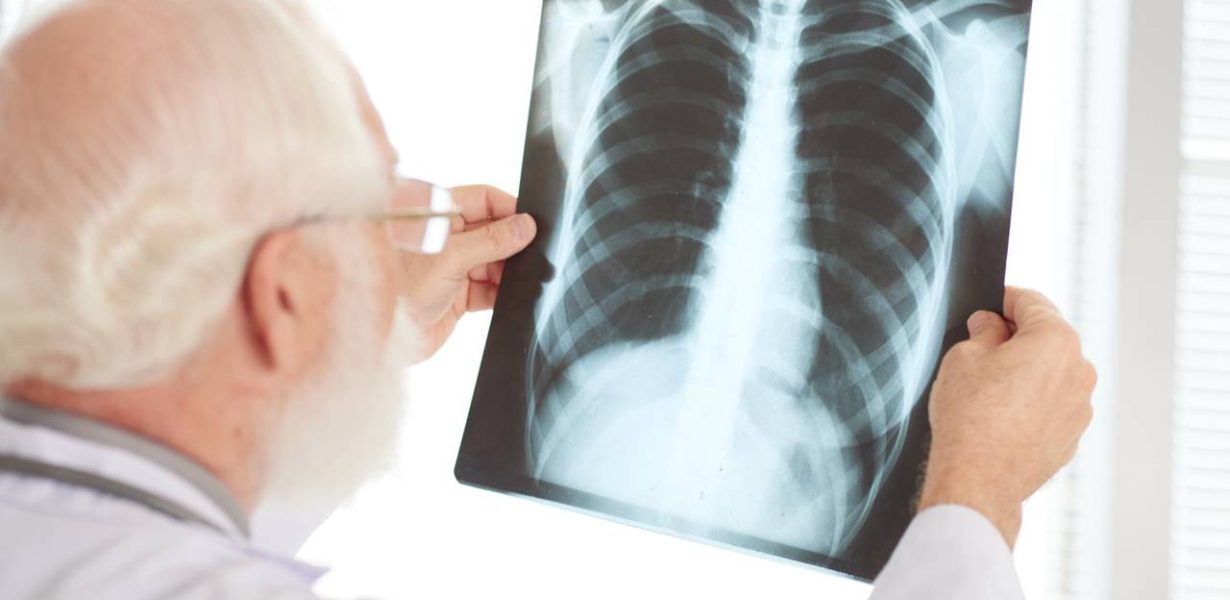 Tuberculose: um olhar sobre a doença que persiste por anos